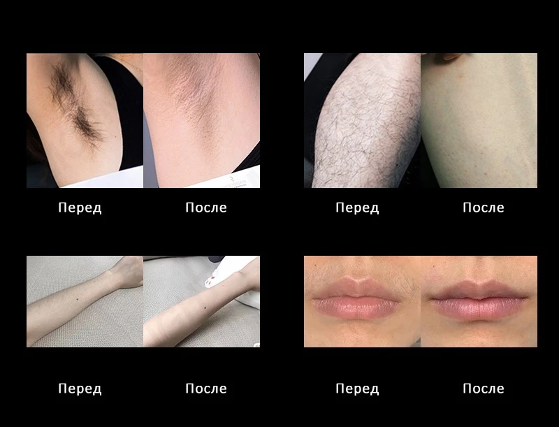 product-800-611 product-800-611